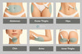 Sculpting Fat Loss Pen