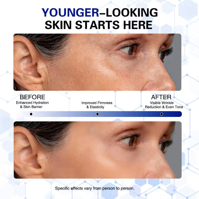 Collagen Regenerator Pen