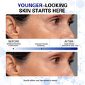 Collagen Regenerator Pen